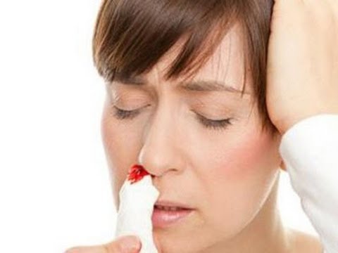 bài thuốc chữa chảy máu cam