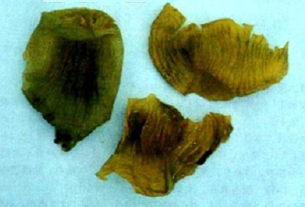 màng mề gà